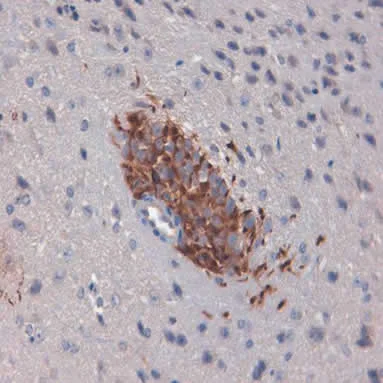 Immunohistochemistry (Formalin/PFA-fixed paraffin-embedded sections) - Anti-Nestin antibody [2C1.3A11] - Neural Stem Cell Marker (AB18102)