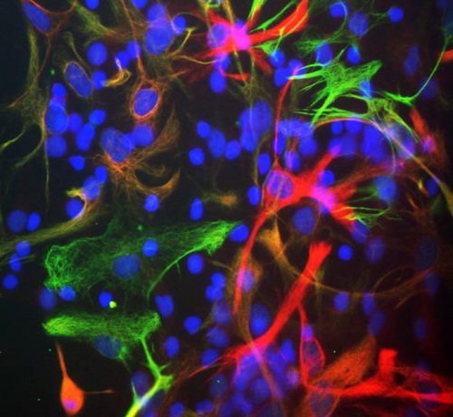 Immunocytochemistry/ Immunofluorescence - Anti-Nestin antibody [4D11] (AB254048), expandable thumbnail