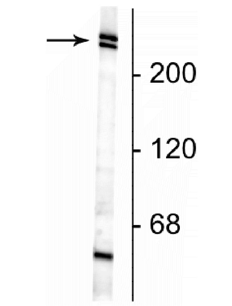 Western blot - Anti-Nestin antibody [4D11] (AB254048), expandable thumbnail