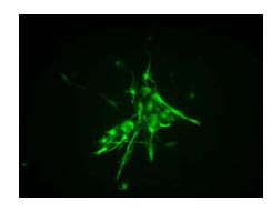 Immunocytochemistry/ Immunofluorescence - Anti-Nestin antibody [7A3] (AB81462), expandable thumbnail