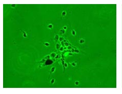 Immunocytochemistry/ Immunofluorescence - Anti-Nestin antibody [7A3] (AB81462), expandable thumbnail