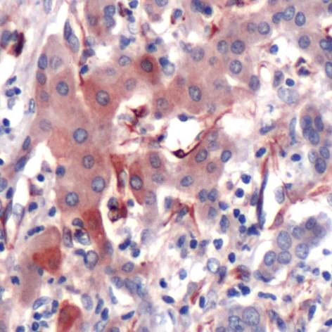 Immunohistochemistry (Formalin/PFA-fixed paraffin-embedded sections) - Anti-Nestin antibody - C-terminal (AB227777)