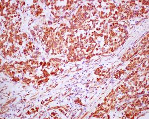 Immunohistochemistry (Formalin/PFA-fixed paraffin-embedded sections) - Anti-Nestin antibody [EPR1301(2)] - BSA and Azide free (AB242400)