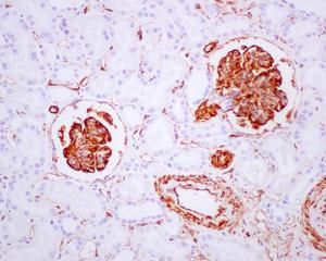 Immunohistochemistry (Formalin/PFA-fixed paraffin-embedded sections) - Anti-Nestin antibody [EPR1301(2)] - BSA and Azide free (ab242400), expandable thumbnail