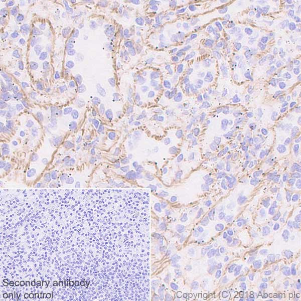 Immunohistochemistry (Formalin/PFA-fixed paraffin-embedded sections) - Anti-Nestin antibody [EPR1301(2)] - BSA and Azide free (AB242400), expandable thumbnail