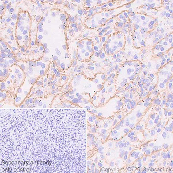 Immunohistochemistry (Formalin/PFA-fixed paraffin-embedded sections) - Anti-Nestin antibody [EPR1301(2)] - BSA and Azide free (AB242400)