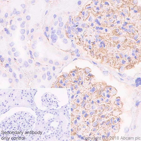 Immunohistochemistry (Formalin/PFA-fixed paraffin-embedded sections) - Anti-Nestin antibody [EPR1301(2)] - BSA and Azide free (AB242400)