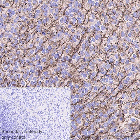 Immunohistochemistry (Formalin/PFA-fixed paraffin-embedded sections) - Anti-Nestin antibody [EPR22023] - BSA and Azide free (AB237036), expandable thumbnail