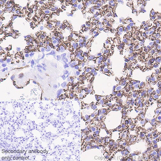Immunohistochemistry (Formalin/PFA-fixed paraffin-embedded sections) - Anti-Nestin antibody [EPR22023] - BSA and Azide free (AB237036), expandable thumbnail