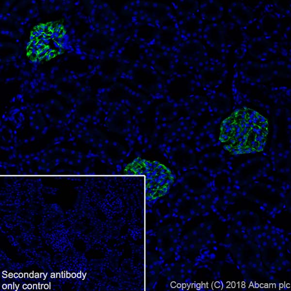 Immunohistochemistry (Frozen sections) - Anti-Nestin antibody [EPR22023] - BSA and Azide free (AB237036), expandable thumbnail