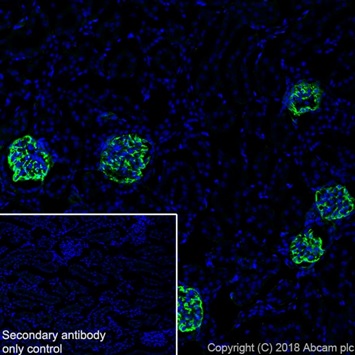Immunohistochemistry (Frozen sections) - Anti-Nestin antibody [EPR22023] - BSA and Azide free (AB237036), expandable thumbnail