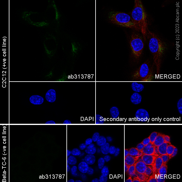 Immunocytochemistry/ Immunofluorescence - Anti-Nestin antibody [EPR27207-53] (AB313787), expandable thumbnail