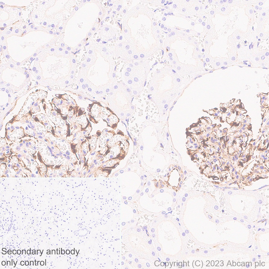 Immunohistochemistry (Formalin/PFA-fixed paraffin-embedded sections) - Anti-Nestin antibody [EPR27207-53] (ab313787), expandable thumbnail