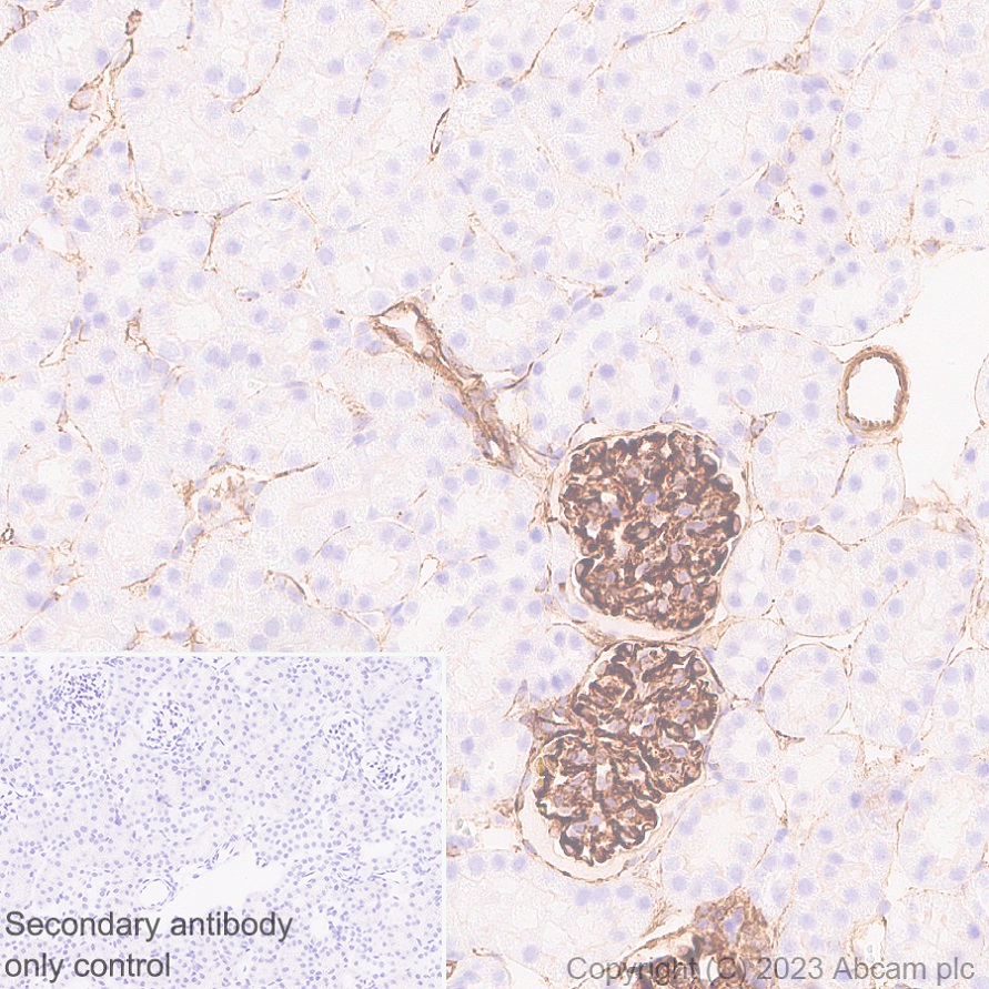 Immunohistochemistry (Formalin/PFA-fixed paraffin-embedded sections) - Anti-Nestin antibody [EPR27207-53] (AB313787), expandable thumbnail