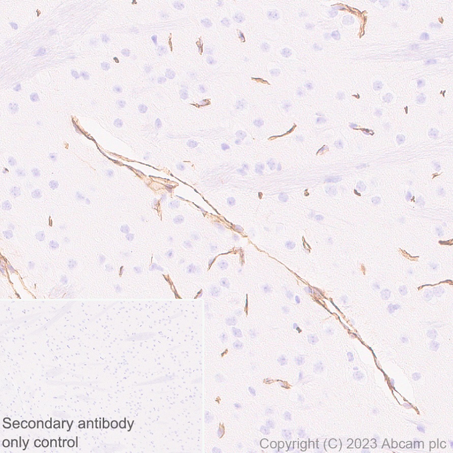 Immunohistochemistry (Formalin/PFA-fixed paraffin-embedded sections) - Anti-Nestin antibody [EPR27207-53] (AB313787), expandable thumbnail