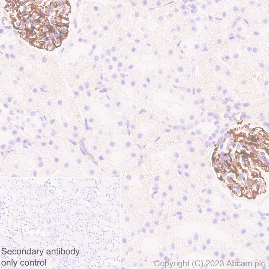 Immunohistochemistry (Formalin/PFA-fixed paraffin-embedded sections) - Anti-Nestin antibody [EPR27207-53] (AB313787), expandable thumbnail