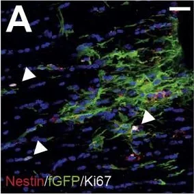 Immunocytochemistry/ Immunofluorescence - Anti-Nestin antibody - Neural Stem Cell Marker (AB134017)