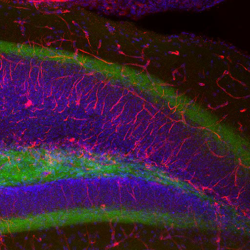 Immunohistochemistry (Formalin/PFA-fixed paraffin-embedded sections) - Anti-Nestin antibody - Neural Stem Cell Marker (AB134017), expandable thumbnail