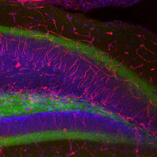 Immunohistochemistry (Formalin/PFA-fixed paraffin-embedded sections) - Anti-Nestin antibody - Neural Stem Cell Marker (AB134017)
