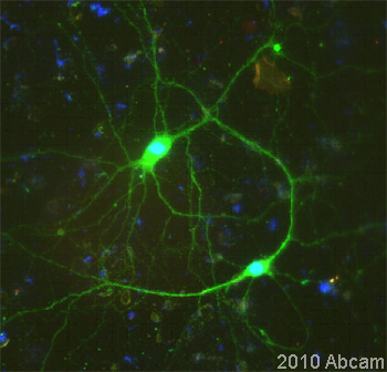 Immunocytochemistry/ Immunofluorescence - Anti-Nestin antibody - Neural Stem Cell Marker (AB92391), expandable thumbnail