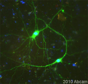 Immunocytochemistry/ Immunofluorescence - Anti-Nestin antibody - Neural Stem Cell Marker (AB92391)