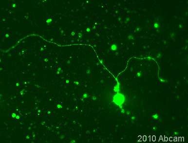 Immunocytochemistry/ Immunofluorescence - Anti-Nestin antibody - Neural Stem Cell Marker (AB92391), expandable thumbnail