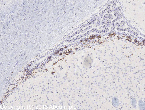 Immunohistochemistry (Formalin/PFA-fixed paraffin-embedded sections) - Anti-Nestin antibody [Rat-401] - BSA and Azide free (AB264111)