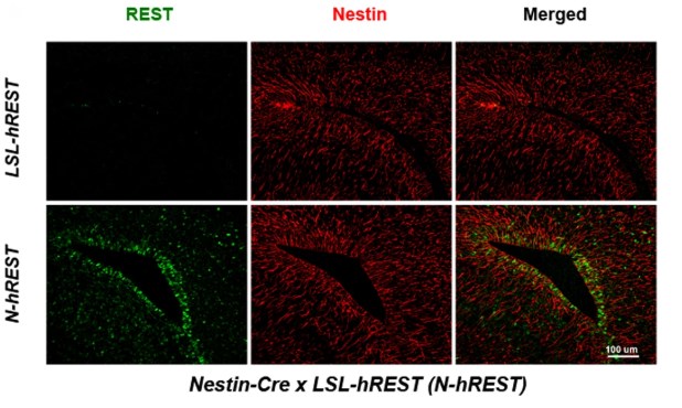 Immunohistochemistry (Formalin/PFA-fixed paraffin-embedded sections) - Anti-Nestin antibody [Rat-401] - Neural Stem Cell Marker (AB6142), expandable thumbnail