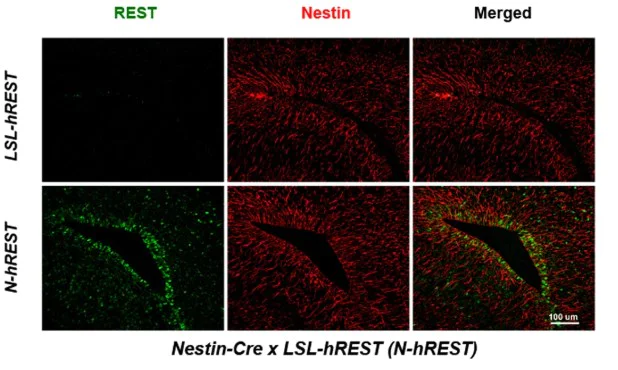 Immunohistochemistry (Formalin/PFA-fixed paraffin-embedded sections) - Anti-Nestin antibody [Rat-401] - Neural Stem Cell Marker (AB6142)