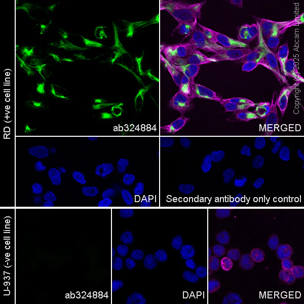 Immunocytochemistry/ Immunofluorescence - Anti-Nestin antibody [RM1345] (AB324884)