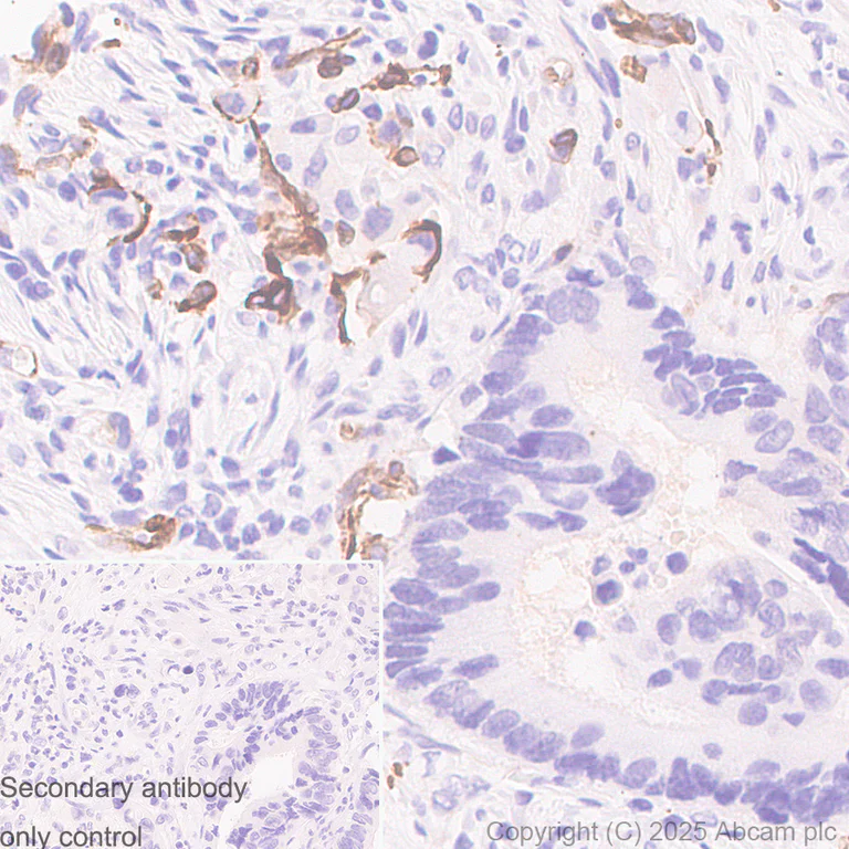 Immunohistochemistry (Formalin/PFA-fixed paraffin-embedded sections) - Anti-Nestin antibody [RM1345] (AB324884)