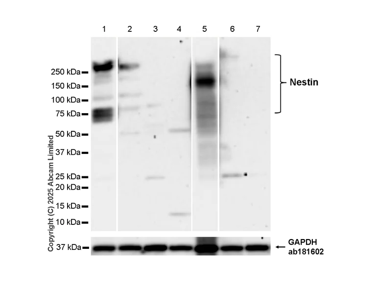 Western blot - Anti-Nestin antibody [RM1345] (AB324884)