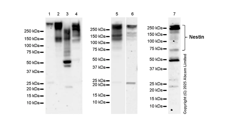 Western blot - Anti-Nestin antibody [RM1345] (AB324884)