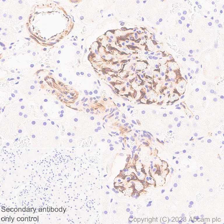 Immunohistochemistry (Formalin/PFA-fixed paraffin-embedded sections) - Anti-Nestin antibody [RM2043] - BSA and Azide free (AB316019)
