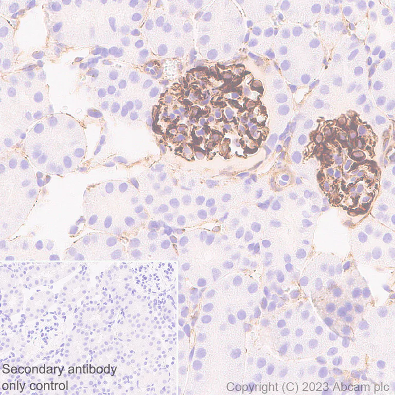 Immunohistochemistry (Formalin/PFA-fixed paraffin-embedded sections) - Anti-Nestin antibody [RM2043] - BSA and Azide free (AB316019)