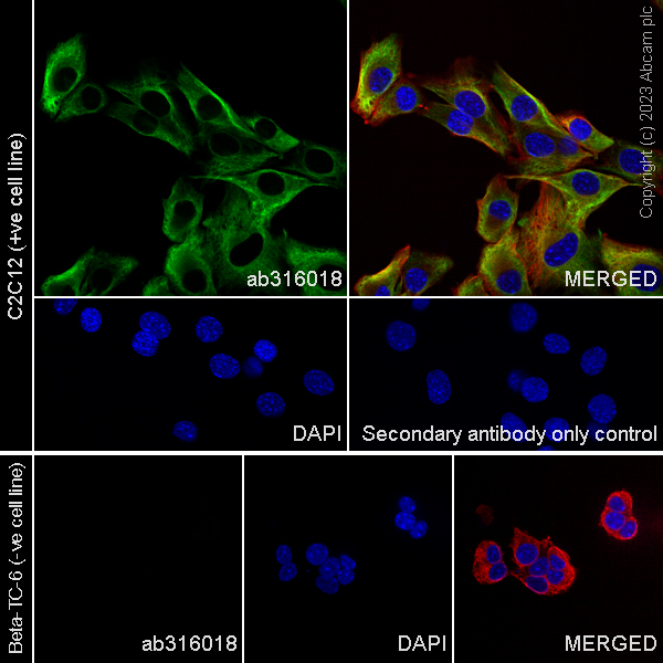 Immunocytochemistry/ Immunofluorescence - Anti-Nestin antibody [RM2043] (AB316018), expandable thumbnail