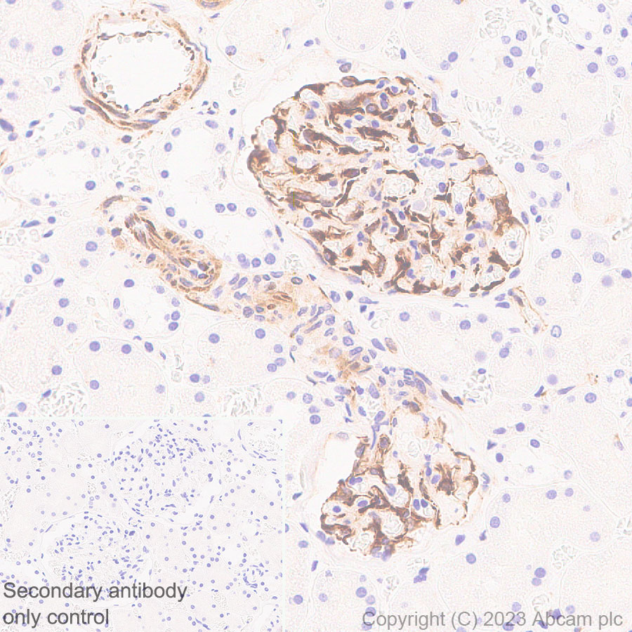 Immunohistochemistry (Formalin/PFA-fixed paraffin-embedded sections) - Anti-Nestin antibody [RM2043] (ab316018), expandable thumbnail