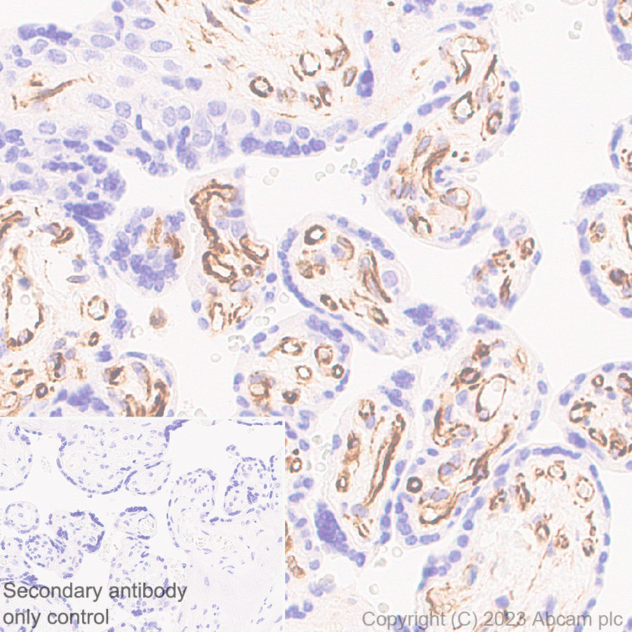 Immunohistochemistry (Formalin/PFA-fixed paraffin-embedded sections) - Anti-Nestin antibody [RM2043] (ab316018), expandable thumbnail
