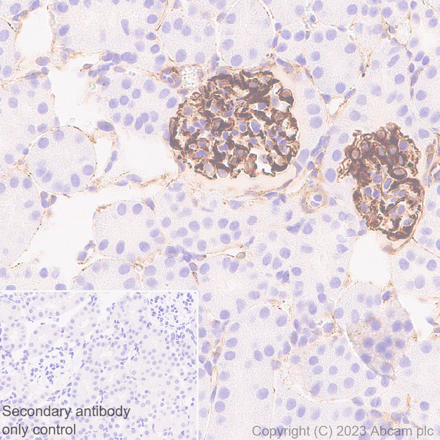 Immunohistochemistry (Formalin/PFA-fixed paraffin-embedded sections) - Anti-Nestin antibody [RM2043] (ab316018), expandable thumbnail