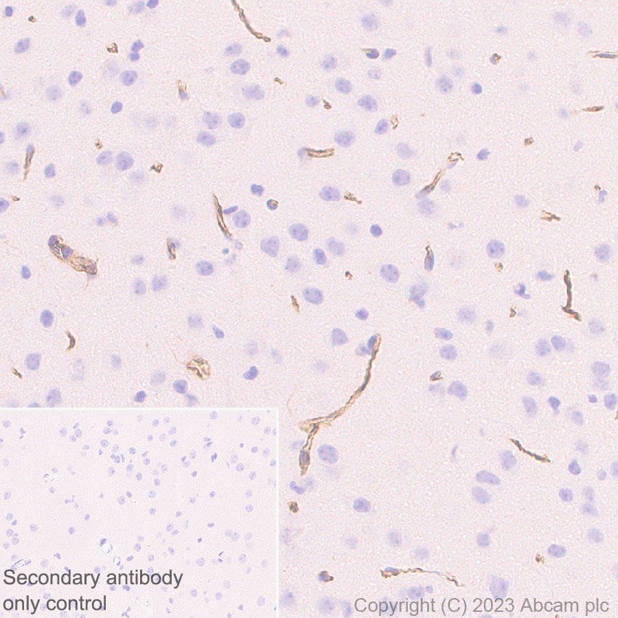 Immunohistochemistry (Formalin/PFA-fixed paraffin-embedded sections) - Anti-Nestin antibody [RM2043] (ab316018), expandable thumbnail
