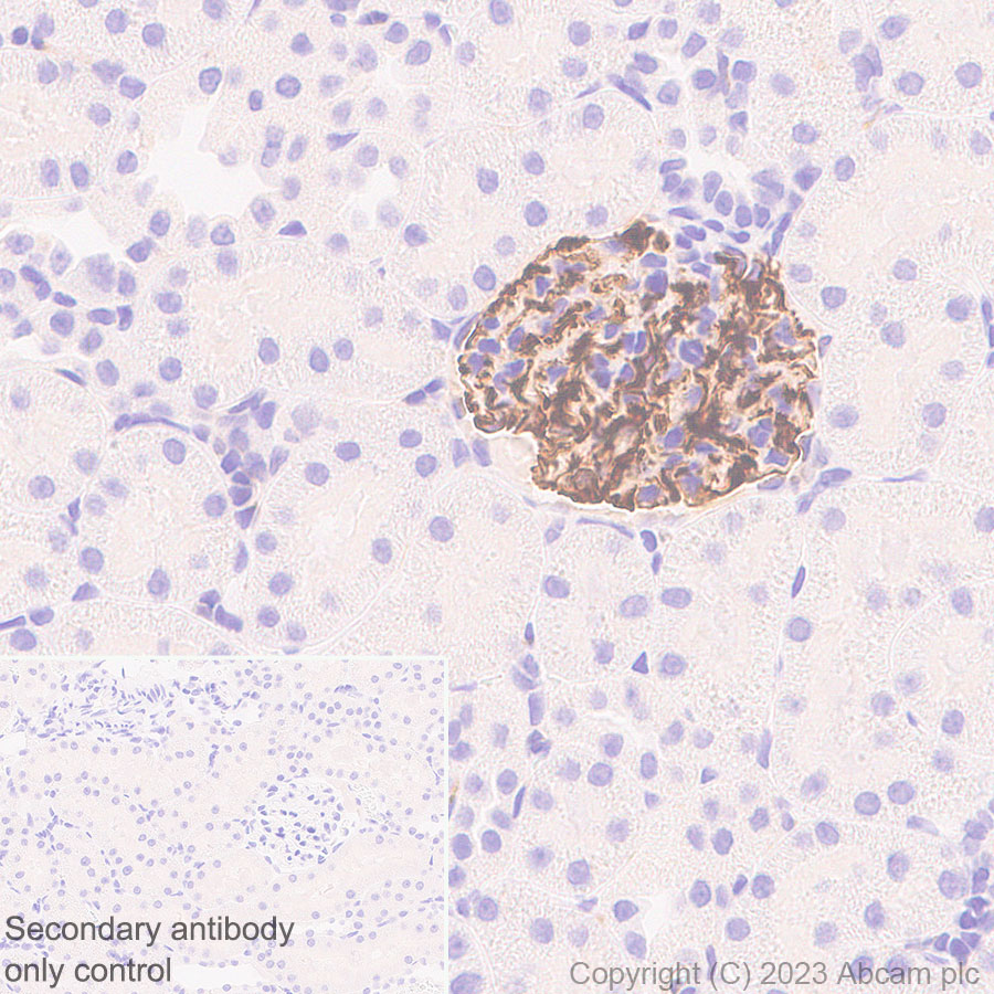 Immunohistochemistry (Formalin/PFA-fixed paraffin-embedded sections) - Anti-Nestin antibody [RM2043] (AB316018), expandable thumbnail