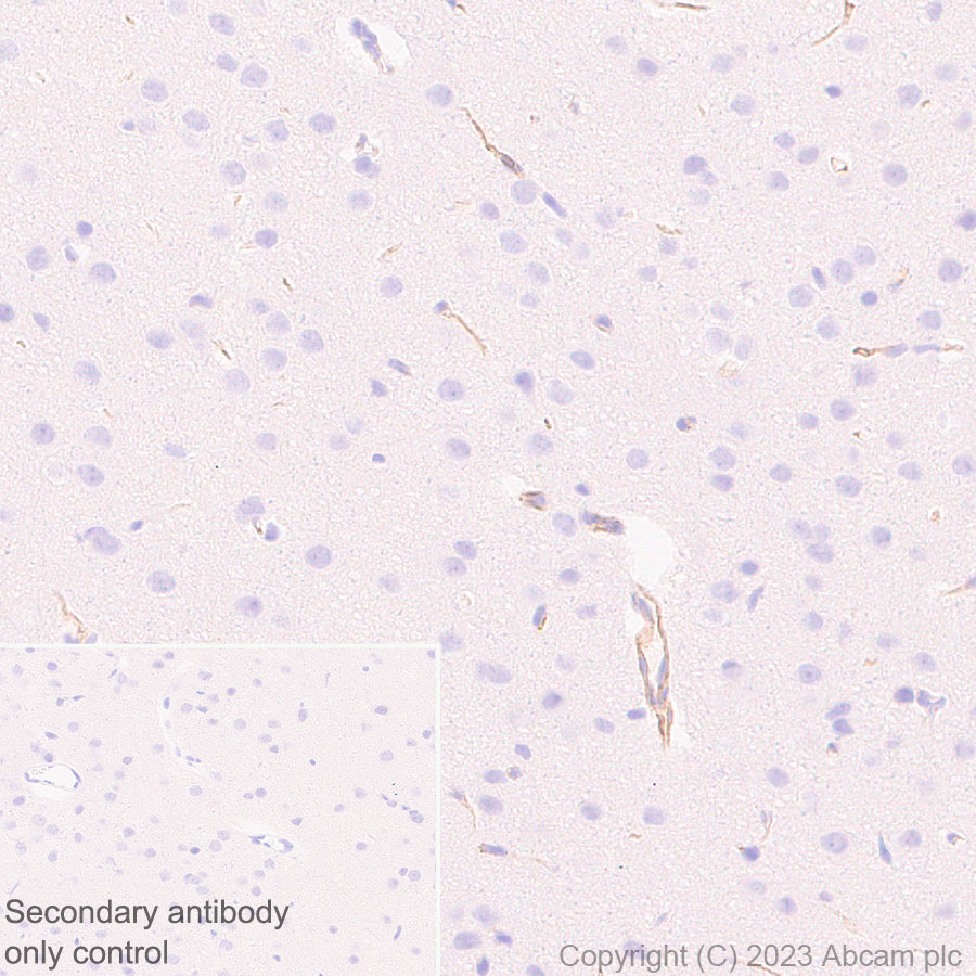 Immunohistochemistry (Formalin/PFA-fixed paraffin-embedded sections) - Anti-Nestin antibody [RM2043] (AB316018), expandable thumbnail