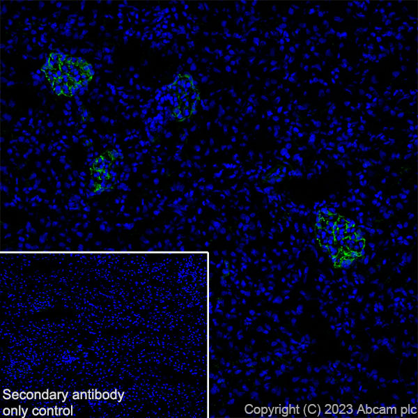 Immunohistochemistry (Frozen sections) - Anti-Nestin antibody [RM2043] (AB316018), expandable thumbnail