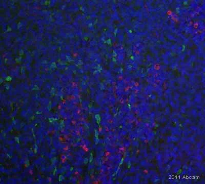 Immunohistochemistry (Formalin/PFA-fixed paraffin-embedded sections) - Anti-Nestin antibody [SP103] - BSA and Azide free (AB271870)