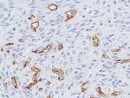 Immunohistochemistry (Formalin/PFA-fixed paraffin-embedded sections) - Anti-Nestin antibody [SP103] (ab105389), expandable thumbnail