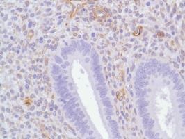 Immunohistochemistry (Formalin/PFA-fixed paraffin-embedded sections) - Anti-Nestin antibody [SP103] (AB105389), expandable thumbnail