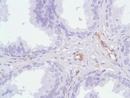 Immunohistochemistry (Formalin/PFA-fixed paraffin-embedded sections) - Anti-Nestin antibody [SP103] (ab105389), expandable thumbnail