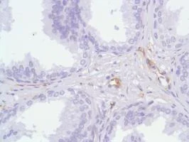 Immunohistochemistry (Formalin/PFA-fixed paraffin-embedded sections) - Anti-Nestin antibody [SP103] - Neural Stem Cell Marker (AB105389)