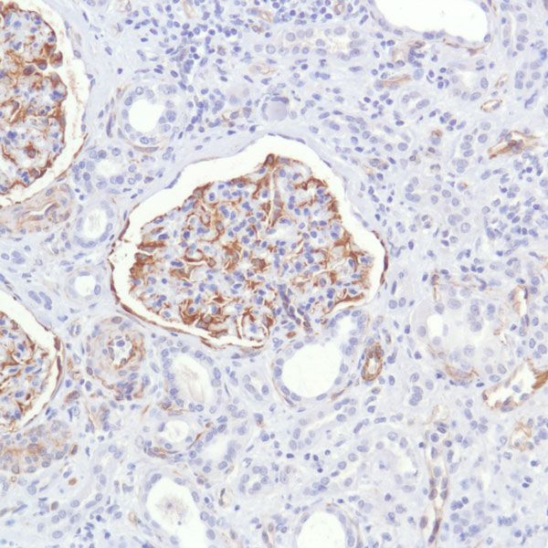 Immunohistochemistry (Formalin/PFA-fixed paraffin-embedded sections) - Anti-Nestin antibody [SP103] (ab105389), expandable thumbnail