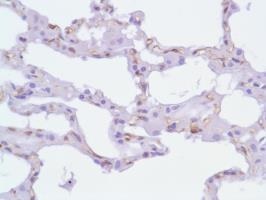 Immunohistochemistry (Formalin/PFA-fixed paraffin-embedded sections) - Anti-Nestin antibody [SP103] (ab105389), expandable thumbnail
